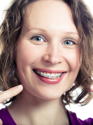 For Adults - Lisa Angelici Orthodontics | Fountain Valley CA